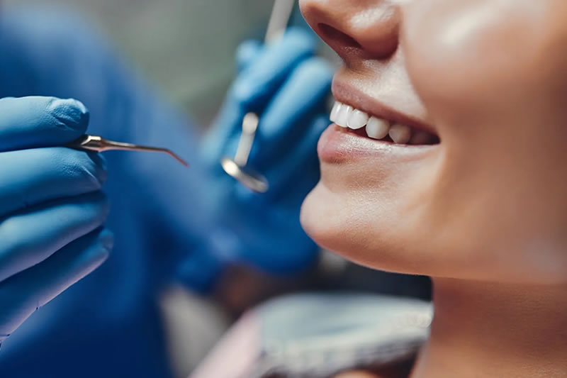 Détartrage et soins des caries